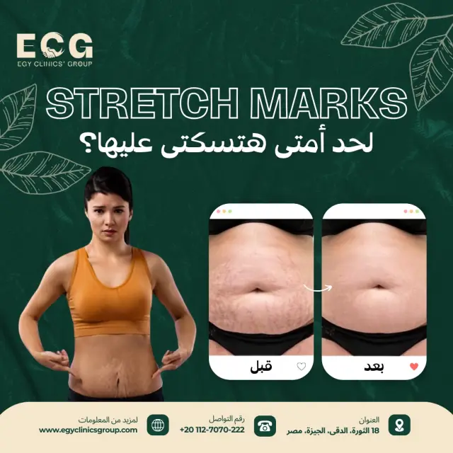 مجموعة إيجي كلينكس - تصميم سوشيال ميديا 6 | أعمال MAZCODEX
