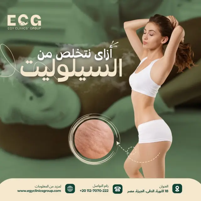 مجموعة إيجي كلينكس - تصميم سوشيال ميديا 7 | أعمال MAZCODEX