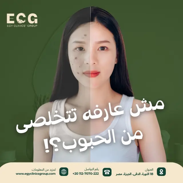 مجموعة إيجي كلينكس - تصميم سوشيال ميديا 45 | أعمال MAZCODEX