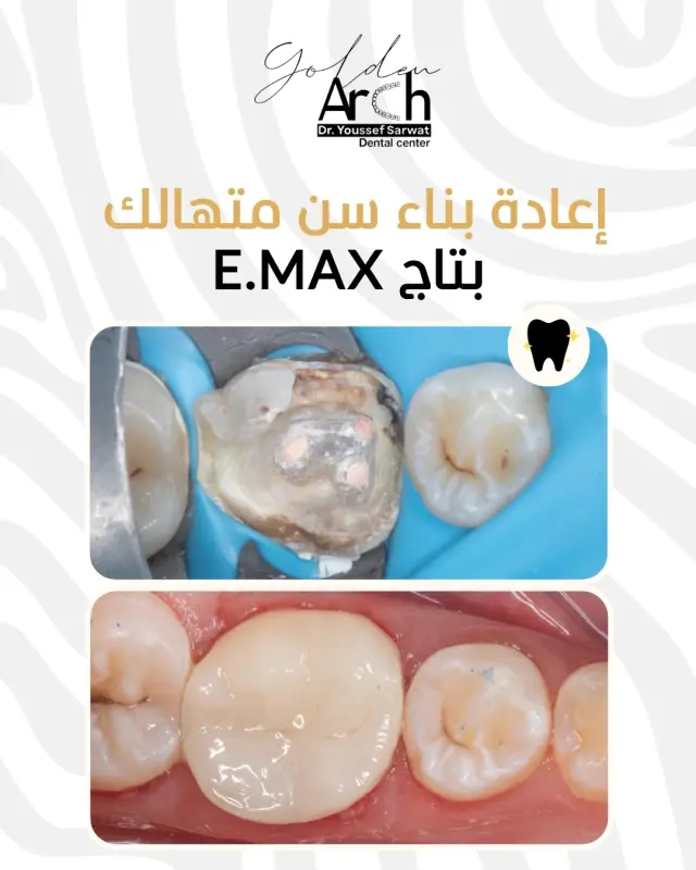 جولدن آرك - تصميم سوشيال ميديا 73 | أعمال MAZCODEX