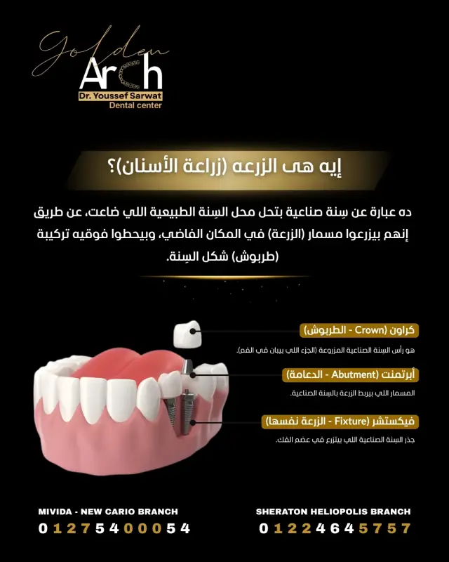 جولدن آرك - تصميم سوشيال ميديا 103 | أعمال MAZCODEX