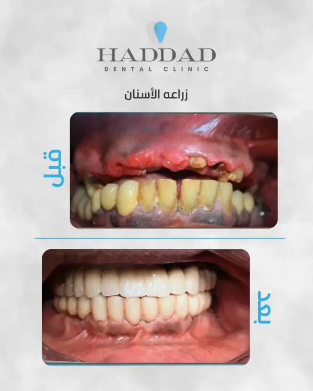 عيادة د. باسم حداد - تصميم سوشيال ميديا 1 | أعمال MAZCODEX