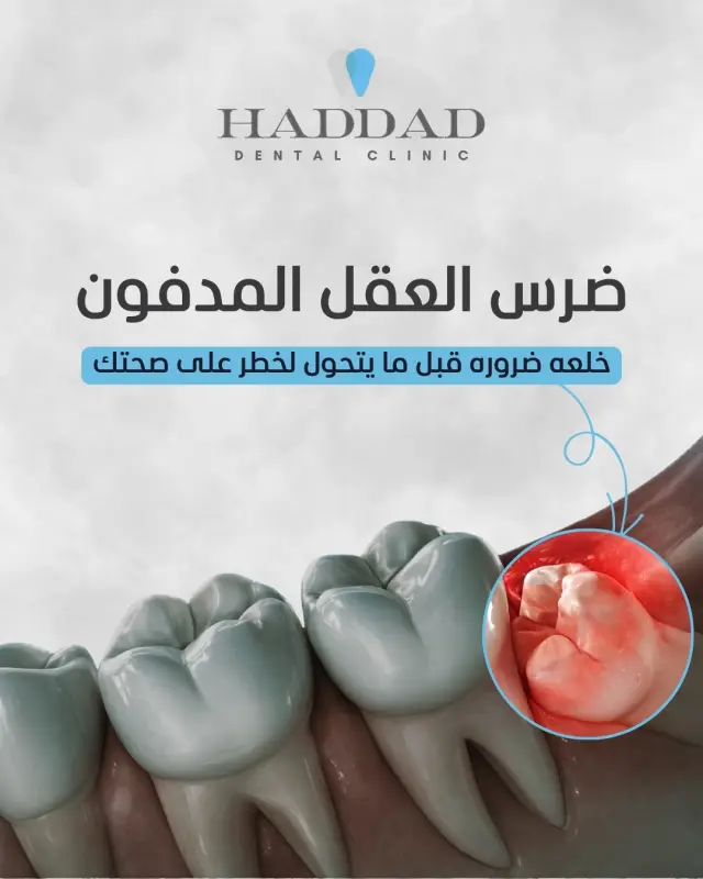 عيادة د. باسم حداد - تصميم سوشيال ميديا 4 | أعمال MAZCODEX