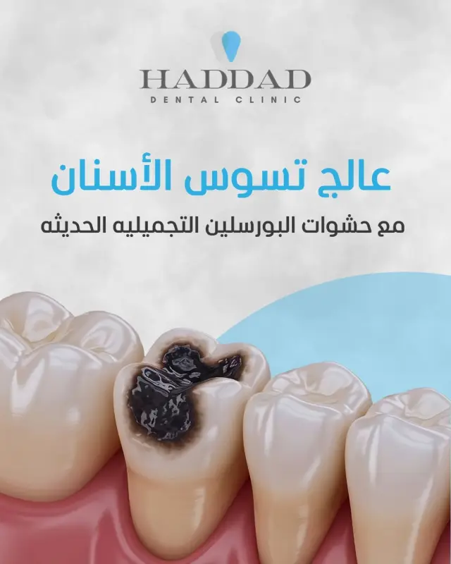 عيادة د. باسم حداد - تصميم سوشيال ميديا 12 | أعمال MAZCODEX
